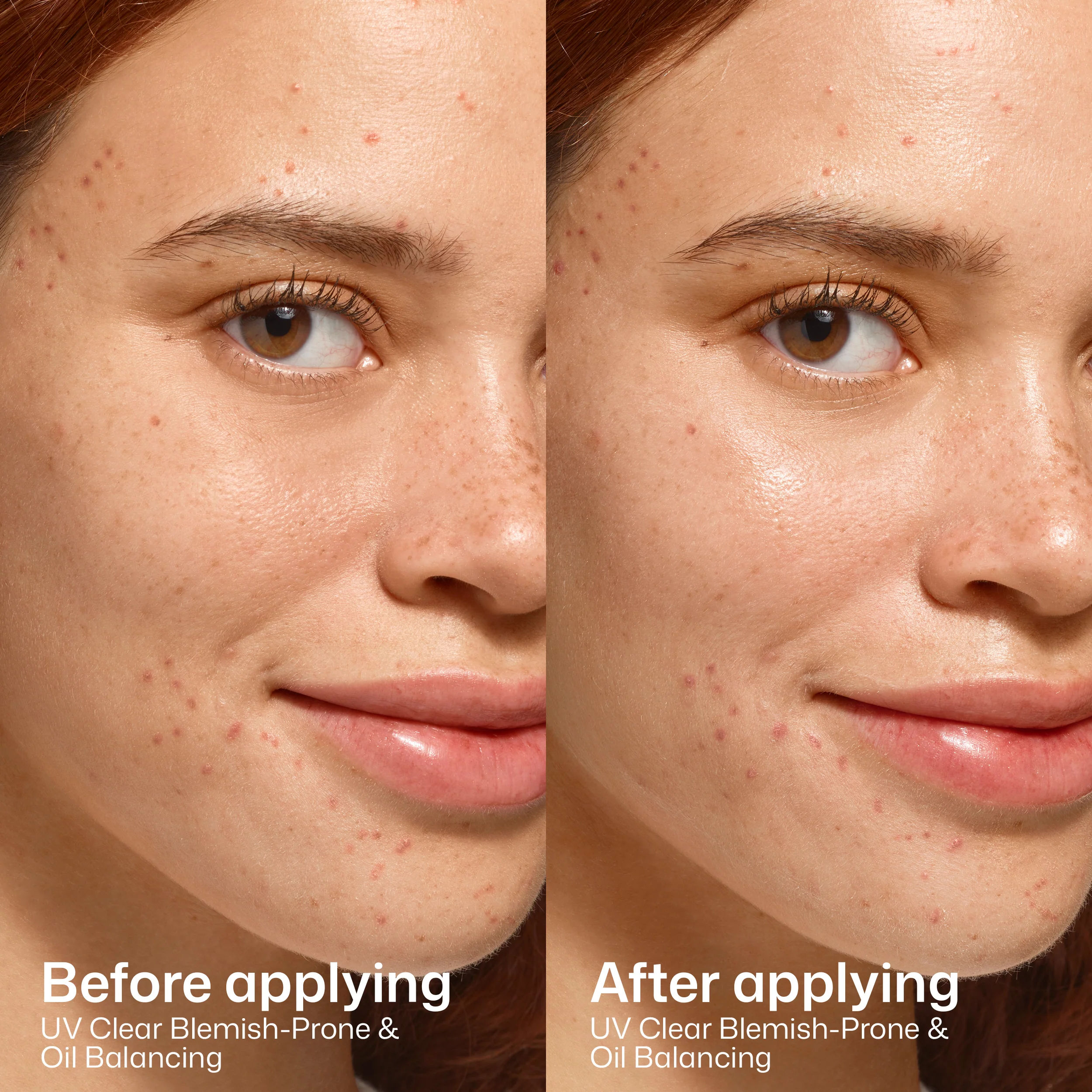 EltaMD UV Clear Blemish-Prone & Oil Balancing SPF 50 - Image 6