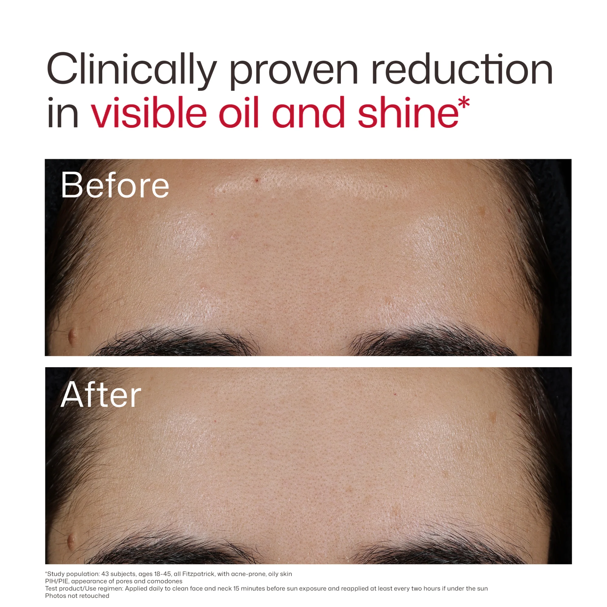 EltaMD UV Clear Blemish-Prone & Oil Balancing SPF 50 - Image 8