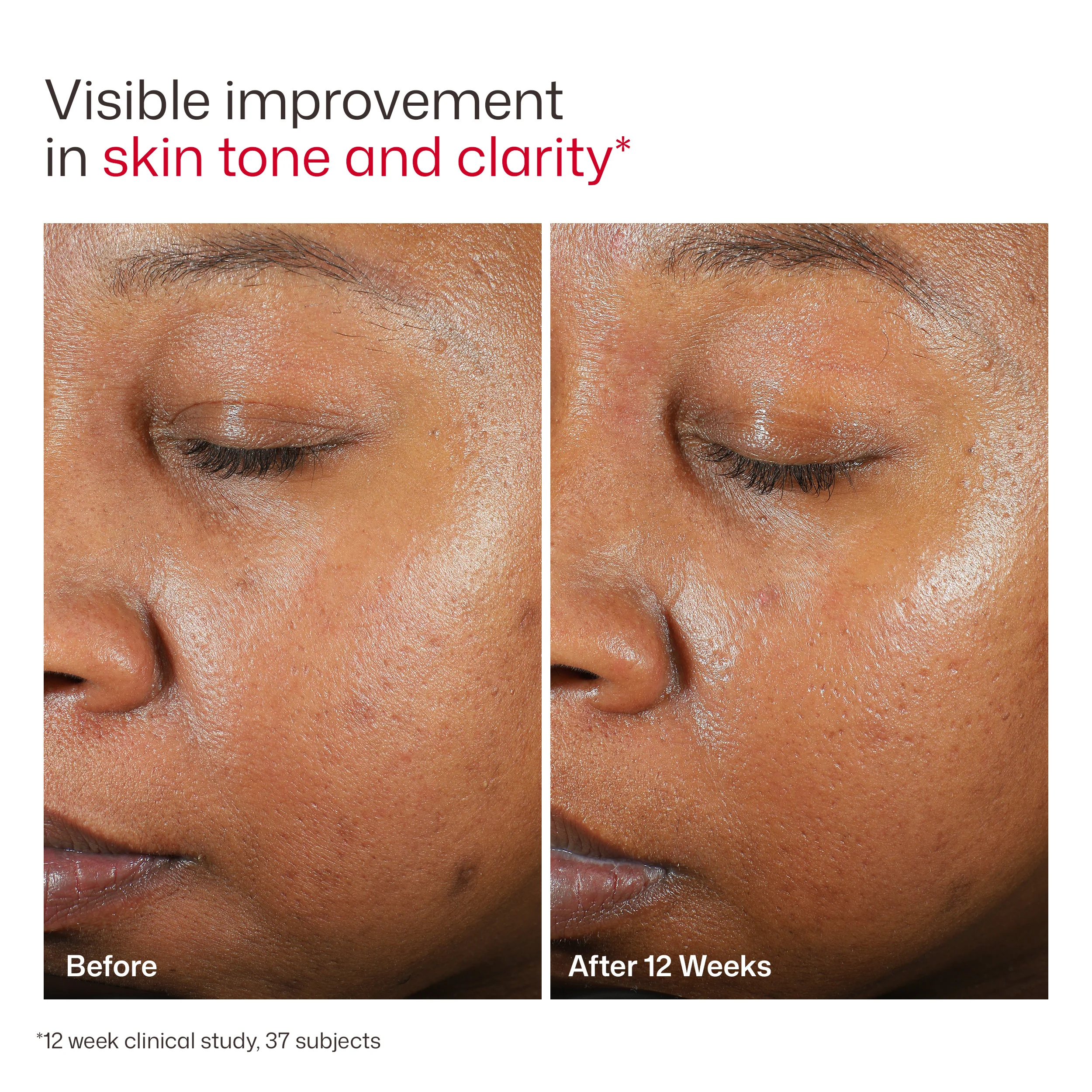 We Made Too Many: EltaMD UV Clear Deep Tinted Spectrum SPF 46 - Image 10