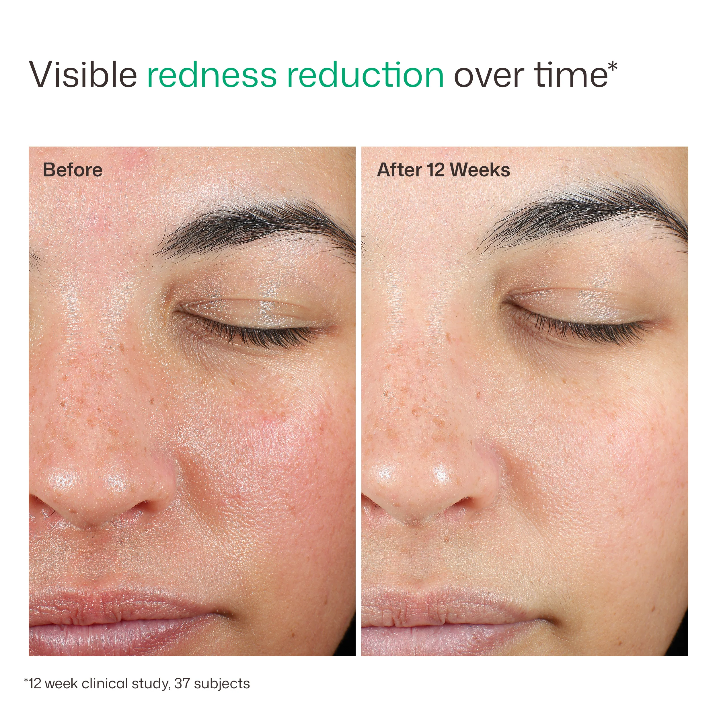 EltaMD UV Skin Recovery Broad Spectrum SPF 50 Face Sunscreen - Image 9